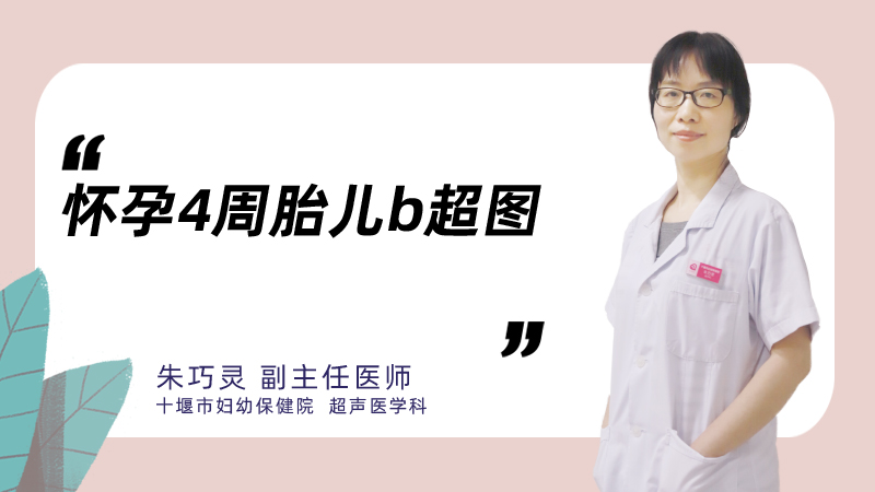 怀孕4月胎儿b超图