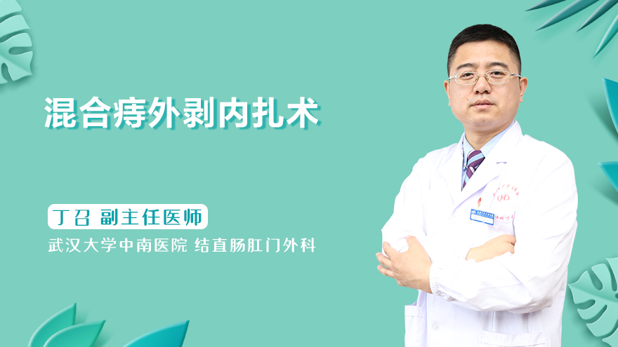 混合痔外剥内扎术
