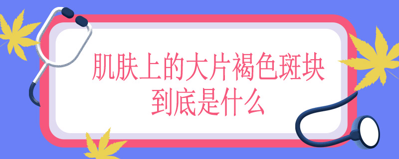 肌肤上的大片褐色斑块到底是什么