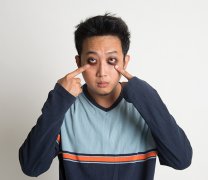 生姜去眼袋有效吗，消除眼袋的小技巧
