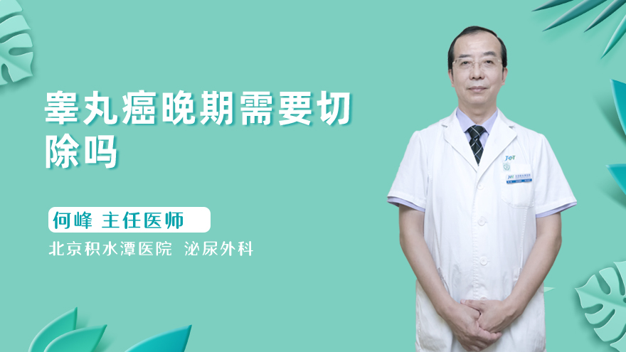 睾丸癌晚期需要切除吗