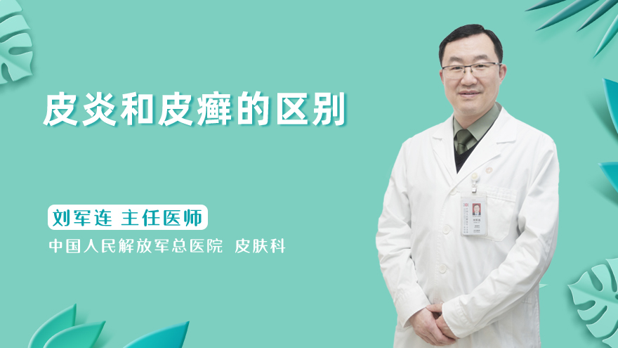 皮炎和皮癣的区别