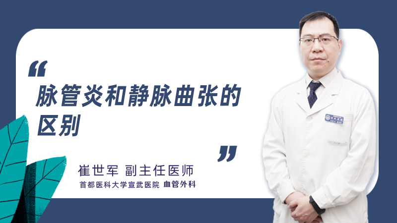 脉管炎和静脉曲张的区别