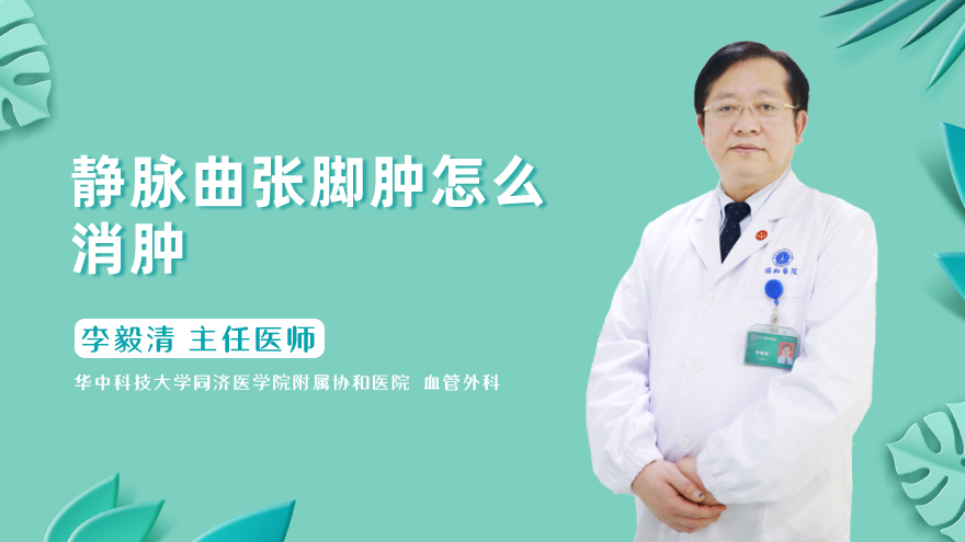 静脉曲张脚肿怎么消肿