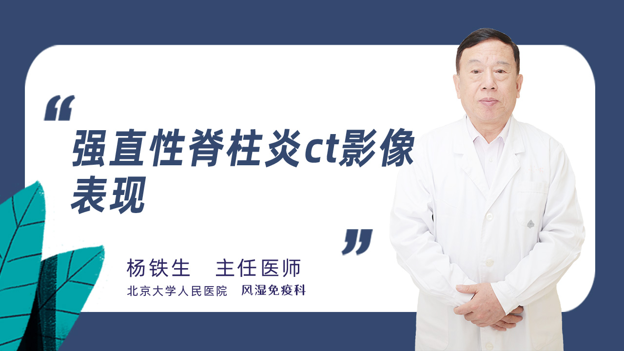 强直性脊柱炎ct影像表现