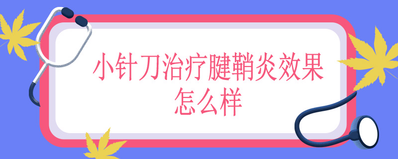 小针刀治疗腱鞘炎效果怎么样